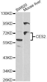 Anti-CES2 Antibody