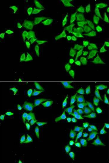 Anti-CES2 Antibody