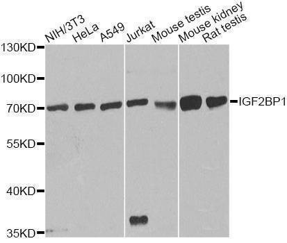 Anti-IGF2BP1 Antibody