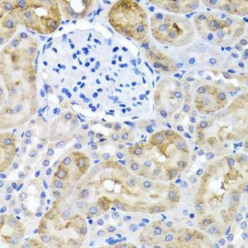 Anti-SULT1A1 Antibody