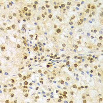 Anti-ELAVL1 Antibody