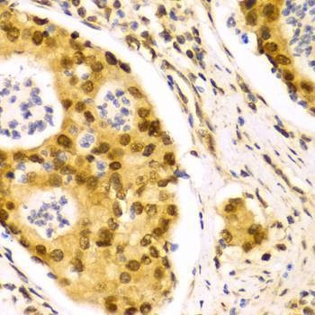 Anti-ELAVL1 Antibody