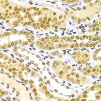 Anti-ELAVL1 Antibody
