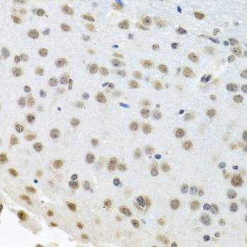 Anti-ELAVL1 Antibody