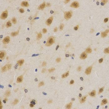 Anti-ELAVL1 Antibody