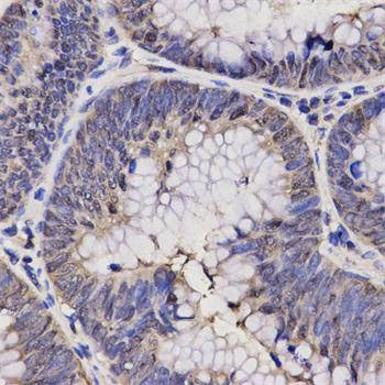 Anti-NPPA Antibody