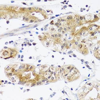 Anti-NPPA Antibody