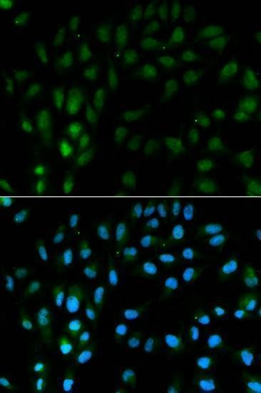 Anti-TFPI Antibody