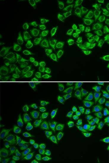 Anti-HMGCR Antibody