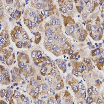 Anti-UGT1A9 Antibody