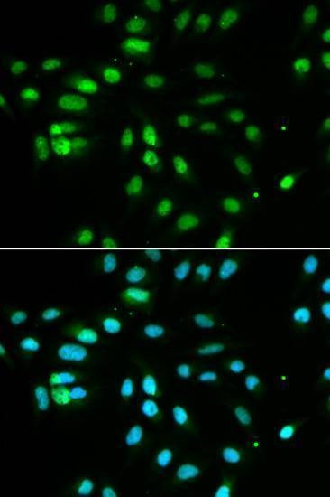 Anti-PAX3 Antibody