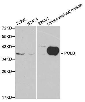 Anti-POLB Antibody