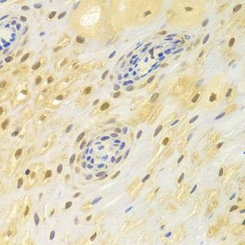 Anti-POLB Antibody