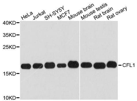 Anti-CFL1 Antibody