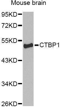 Anti-CTBP1 Antibody