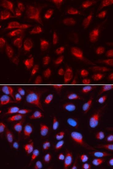 Anti-CTBP1 Antibody