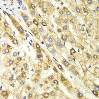Anti-CTBP1 Antibody