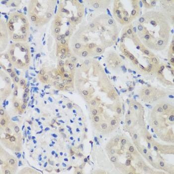 Anti-UBE3A Antibody