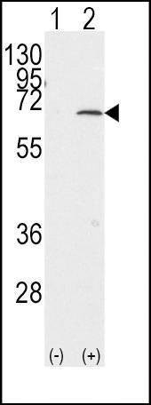 Anti-PIAS1 (C-term) Antibody