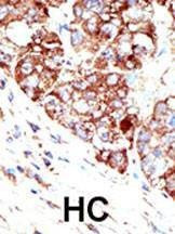 Anti-PIAS1 (C-term) Antibody