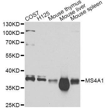 Anti-MS4A1 Antibody