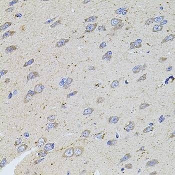 Anti-ALDH1A1 Antibody