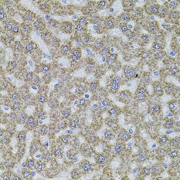 Anti-ALDH1A1 Antibody