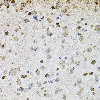 Anti-ALDH1A1 Antibody