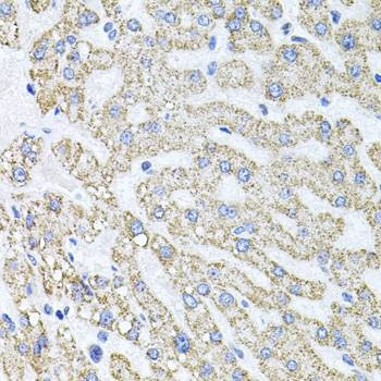 Anti-SDC2 Antibody