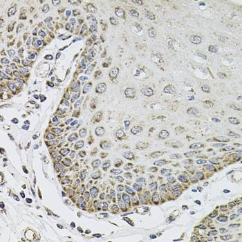Anti-SDC2 Antibody