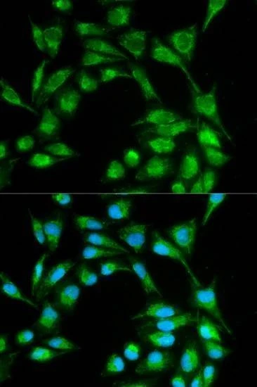 Anti-ICOS Antibody