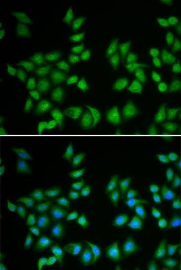 Anti-EIF6 Antibody