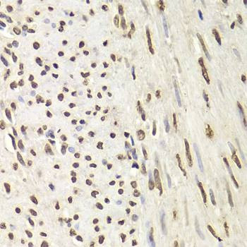Anti-HNRNPD Antibody