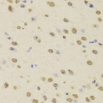 Anti-HNRNPD Antibody