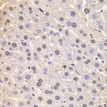 Anti-HNRNPD Antibody