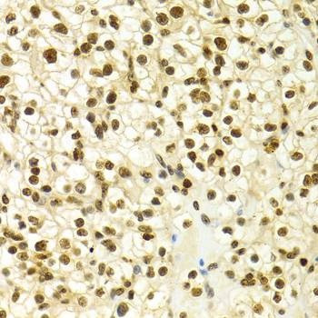 Anti-IKZF1 Antibody