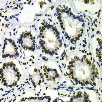 Anti-IKZF1 Antibody