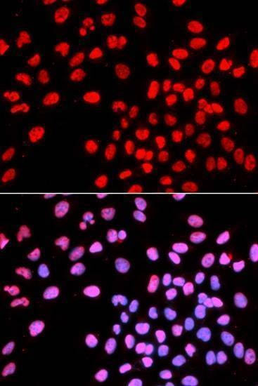 Anti-IKZF1 Antibody