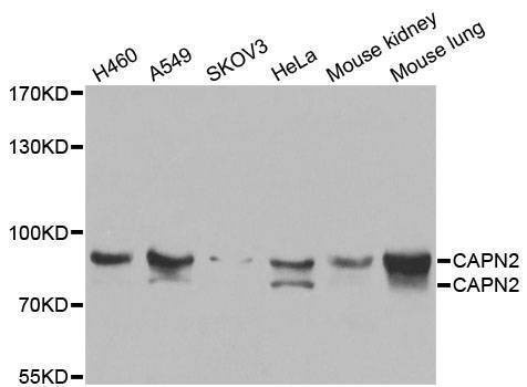 Anti-CAPN2 Antibody