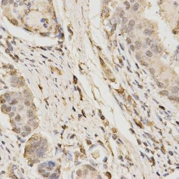Anti-GLB1 Antibody
