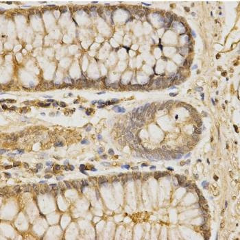 Anti-GLB1 Antibody