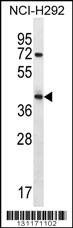 Anti-ARRDC5 (N-term) Antibody