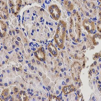 Anti-EPHX2 Antibody