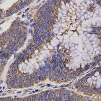 Anti-EPHX2 Antibody