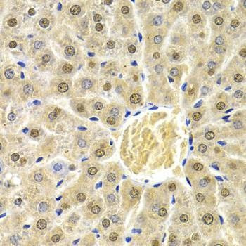 Anti-RAD9A Antibody