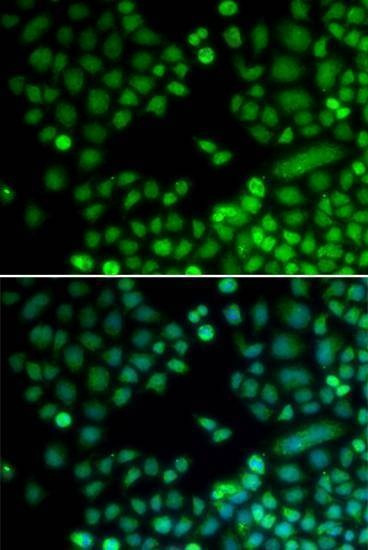 Anti-RAD9A Antibody