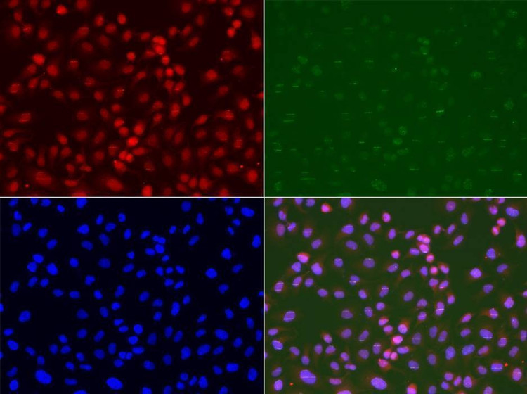 Anti-RAD9A Antibody