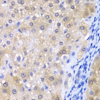 Anti-GPX4 Antibody