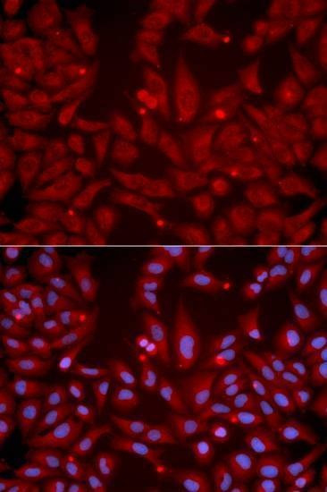 Anti-GRIK2 Antibody