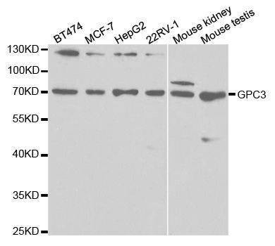Anti-GPC3 Antibody